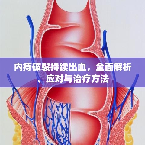 內(nèi)痔破裂持續(xù)出血，全面解析、應(yīng)對(duì)與治療方法
