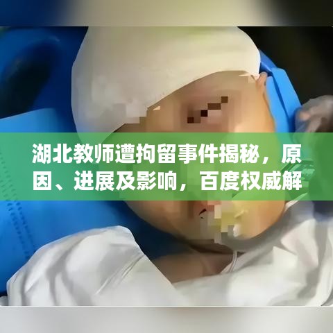 湖北教師遭拘留事件揭秘，原因、進展及影響，百度權威解讀！