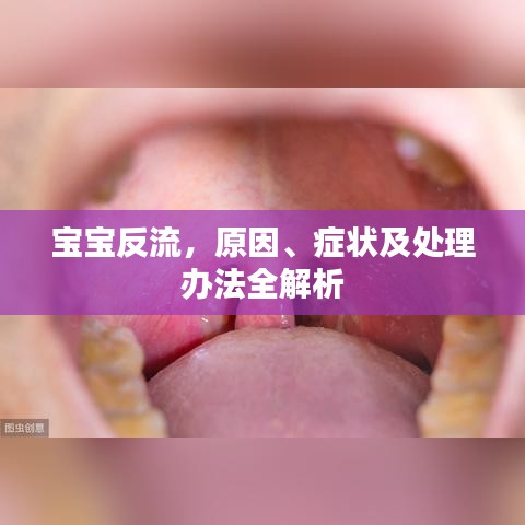 寶寶反流，原因、癥狀及處理辦法全解析