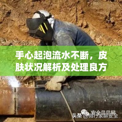 手心起泡流水不斷，皮膚狀況解析及處理良方