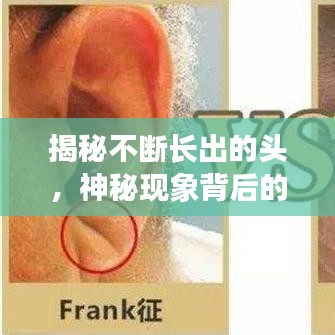 揭秘不斷長(zhǎng)出的頭，神秘現(xiàn)象背后的醫(yī)學(xué)探索之旅